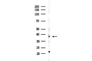 Western blot analysis of lysates from Mouse brain, using CHS Antibody at 1/1000 dilution.