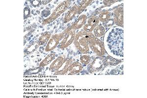 Rabbit Anti-CDH8 Antibody  Paraffin Embedded Tissue: Human Kidney Cellular Data: Epithelial cells of renal tubule Antibody Concentration: 4. (TDO2 Antikörper  (N-Term))