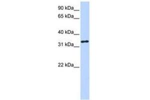 Image no. 1 for anti-3-hydroxyanthranilate 3,4-Dioxygenase (HAAO) (AA 72-121) antibody (ABIN6740761) (HAAO Antikörper  (AA 72-121))