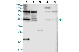 Western blot analysis of Lane 1: RT-4, Lane 2: U-251 MG, Lane 3: Human Plasma, Lane 4: Liver, Lane 5: Tonsil with TOX4 polyclonal antibody  at 1:250-1:500 dilution. (TOX4 Antikörper)