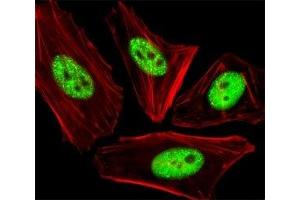 Fluorescent image of HeLa cells stained with phospho-CDC25A antibody at 1:25 dilution.