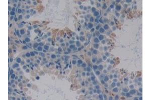 anti-serpin Peptidase Inhibitor, Clade A (Alpha-1 Antiproteinase, Antitrypsin), Member 10 (SERPINA10) (AA 22-448) antibody