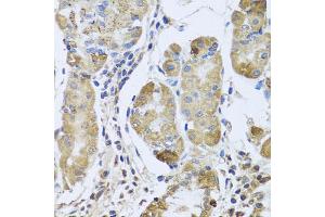 Immunohistochemistry of paraffin-embedded human stomach using EFHC1 antibody. (EFHC1 Antikörper)