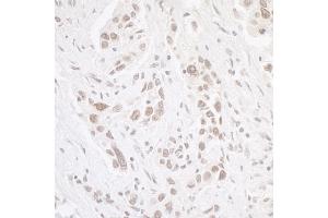 anti-Casein Kinase 2 alpha 1 (CSNK2A1) (AA 300-350) antibody