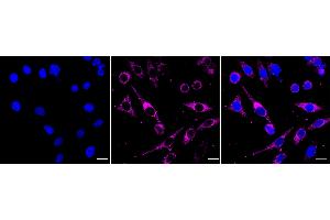 Immunocytochemical staining of HepG2 cells with SEC61A1/2 antibody (ABIN7800968), 1:1,000). (Rekombinanter SEC61A1/2 Antikörper)