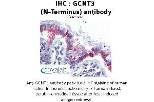 Image no. 2 for anti-Glucosaminyl (N-Acetyl) Transferase 3, Mucin Type (GCNT3) (N-Term) antibody (ABIN1734656)