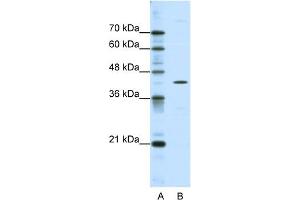 WB Suggested Anti-DOK2 Antibody Titration:  0. (DOK2 Antikörper  (C-Term))