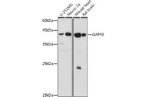 Western blot analysis of extracts of various cell lines, using G antibody (ABIN6127469, ABIN6140954, ABIN6140955 and ABIN6221997) at 1:1000 dilution. (GAP43 Antikörper  (AA 1-238))