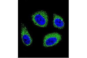 Confocal immunofluorescent analysis of DHCR7 Antibody (C-term) (ABIN655399 and ABIN2844946) with MCF-7 cell followed by Alexa Fluor 488-conjugated goat anti-rabbit lgG (green). (DHCR7 Antikörper  (C-Term))