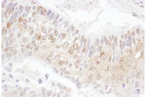 Immunohistochemistry (IHC) image for anti-Cyclin-Dependent Kinase 4 (CDK4) (AA 253-303) antibody (ABIN7455013)