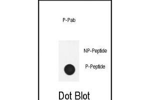 Dot blot analysis of anti-Phospho-Nephrin  antibody Phospho-specific Pab (ABIN650884 and ABIN2839827) on nitrocellulose membrane. (Nephrin Antikörper  (pTyr1210))