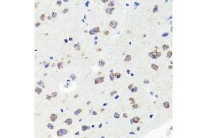 Immunohistochemistry of paraffin-embedded mouse brain using DLG1 antibody (ABIN5996451) at dilution of 1/100 (40x lens). (DLG1 Antikörper)