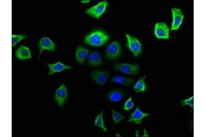 Immunofluorescence staining of A549 cells with ABIN7161414 at 1:166, counter-stained with DAPI. (NPY2R Antikörper  (AA 326-381))