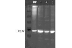 Western blot analysis of Human, Dog, Mouse SKBR3, MDCK, and MEF cell line lysates showing detection of HSP60 protein using Rabbit Anti-HSP60 Polyclonal Antibody . (HSPD1 Antikörper  (PerCP))