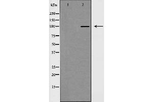 Western blot analysis of extracts from HeLa cells using MKL1 antibody.