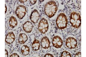 Immunostaining (ISt) image for anti-Aldo-Keto Reductase Family 1, Member B10 (Aldose Reductase) (AKR1B10) (AA 76-143) antibody (ABIN566074)