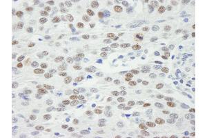 Immunohistochemistry (IHC) image for anti-Mdc1 (MDC1) (AA 1375-1425) antibody (ABIN7448658)