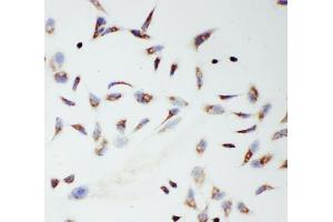 ICC testing of TFAM antibody and HeLa cells (TFAM Antikörper  (C-Term))