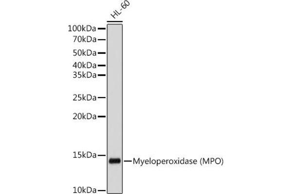 Myeloperoxidase anticorps