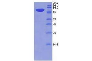 Image no. 1 for Thrombospondin 2 (THBS2) (AA 968-1170) protein (His tag,GST tag) (ABIN6237011)
