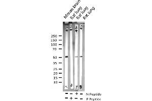 Western blot analysis of Phospho-GSK3 alpha (Ser21) expression in various lysates