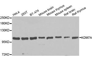 Western blot analysis of extracts of various cell lines, using KDM7A antibody. (JHDM1D Antikörper)