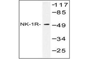 Image no. 1 for anti-Tachykinin Receptor 1 (TACR1) antibody (ABIN317654) (TACR1 Antikörper)