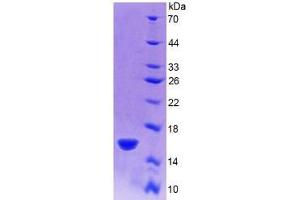 SDS-PAGE analysis of Rat R-Spondin 1 Protein. (RSPO1 Protein)