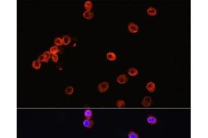 Immunofluorescence (IF) image for anti-CD3 epsilon (CD3E) antibody (ABIN7256106)