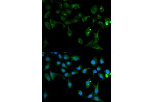 Immunofluorescence analysis of U2OS cells using TOLLIP antibody. (TOLLIP Antikörper)
