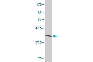 Western Blot detection against Immunogen (35. (SLC2A4RG Antikörper  (AA 178-269))