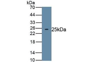 Detection of Recombinant TITF1, Human using Polyclonal Antibody to Thyroid Transcription Factor 1 (TITF1) (NKX2-1 Antikörper)