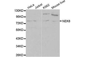 Western blot analysis of extracts of various cell lines, using NEK8 antibody (ABIN5970372) at 1/1000 dilution. (NEK8 Antikörper)