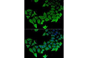 Immunofluorescence analysis of HeLa cell using APLP1 antibody. (APLP1 Antikörper)