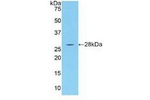 Western blot analysis of recombinant Human IRAK4. (IRAK4 Antikörper  (AA 189-427))