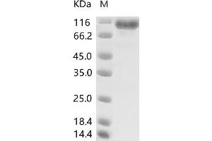 Western Blotting (WB) image for MERS-Coronavirus Spike Protein (MERS-CoV S) protein (His tag) (ABIN7198818) (MERS-Coronavirus Spike Protein (His tag))