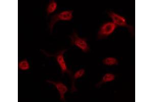 ABIN6274555 staining COLO205 by IF/ICC. (YBX2 Antikörper  (C-Term))