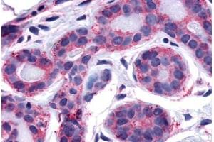 Immunohistochemistry (Paraffin-embedded Sections) (IHC (p)) image for anti-PTK2 Protein tyrosine Kinase 2 (PTK2) (C-Term) antibody (ABIN213411)