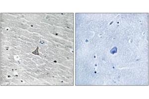 Immunohistochemistry analysis of paraffin-embedded human brain tissue, using VHL (Ab-68) Antibody.