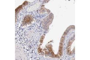 Immunohistochemical staining of human gallbladder with SASH3 polyclonal antibody  shows cytoplasmic positivity in glandular cells. (SASH3 Antikörper)