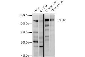 Western blot analysis of extracts of various cell lines, using ZHX2 antibody (ABIN7271565) at 1:1000 dilution. (ZHX2 Antikörper)