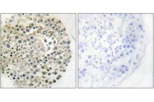 Immunohistochemistry analysis of paraffin-embedded human testis, using TRIM16 Antibody. (TRIM16 Antikörper  (AA 31-80))