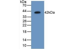 Detection of Recombinant AIMP1, Mouse using Polyclonal Antibody to Aminoacyl tRNA Synthetase Complex Interacting Multifunctional Protein 1 (AIMP1) (AIMP1 Antikörper  (AA 2-310))