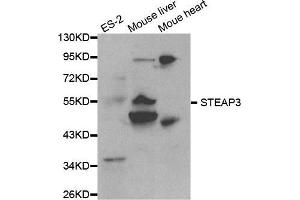 Western blot analysis of extracts of various cell lines, using STEAP3 antibody. (STEAP3 Antikörper  (AA 1-180))