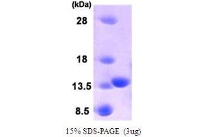 SDS-PAGE (SDS) image for HRAS-Like Suppressor 3 (PLA2G16) (AA 1-133) protein (ABIN666725) (PLA2G16 Protein (AA 1-133))