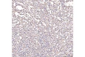 IHC analysis of ANGPT2 using anti-ANGPT2 antibody (ABIN3043725).