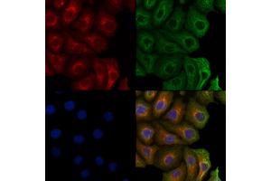 anti-Lysyl Oxidase-Like 4 (LOXL4) (N-Term) antibody
