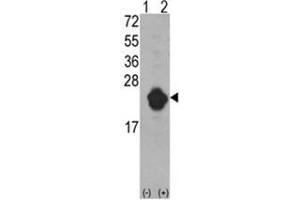 Western blot analysis of IL1RN (arrow) using rabbit polyclonal IL1RN Antibody (Center) . (IL1RN Antikörper  (Middle Region))