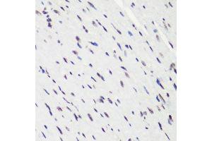 Immunohistochemistry (Paraffin-embedded Sections) (IHC (p)) image for anti-Histone H4 (2meLys20) antibody (ABIN3016048)