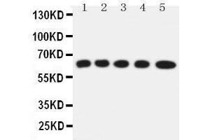 Anti-Solute carrier family 22 member 5 antibody, Western blotting Lane 1: Rat Kidney Tissue Lysate Lane 2: Rat Skeletal Muscles Tissue Lysate Lane 3: Mouse Liver Tissue Lysate Lane 4: HEPA Cell Lysate Lane 5: NIH3T3 Cell Lysate (SLC22A5 Antikörper  (C-Term))